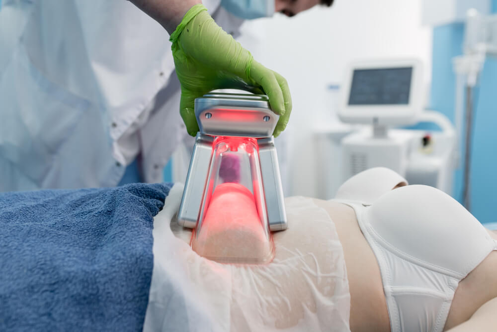 como funciona criolipolise