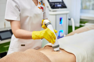 tratamento para estrias