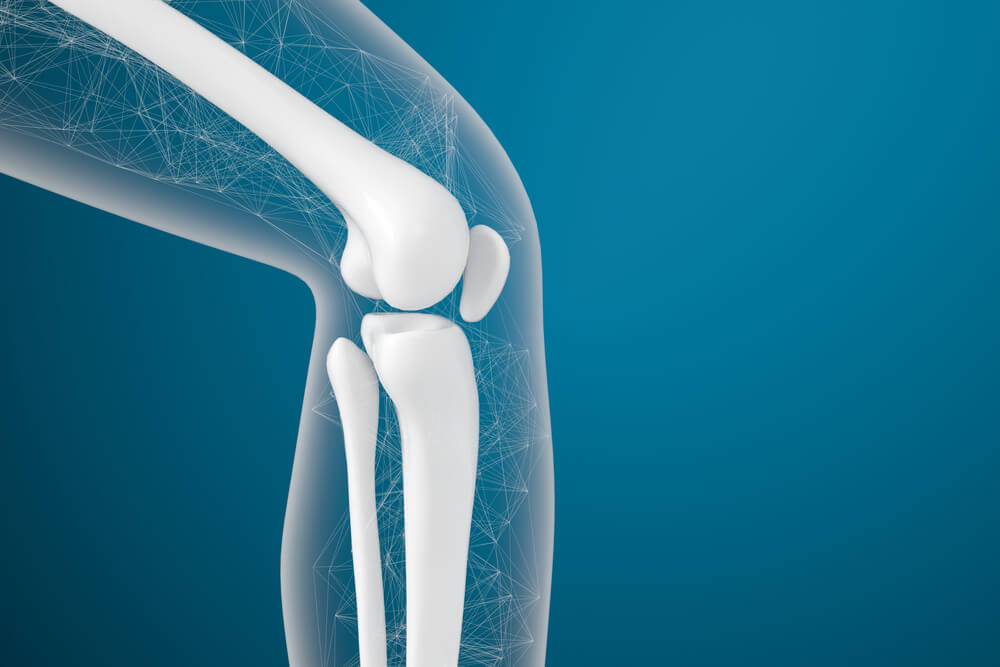 fatores de risco luxação patela